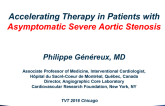 The Case for Accelerating Therapy in Patients With Asymptomatic Severe AS