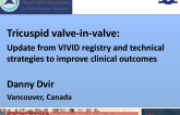 Tricuspid VIV