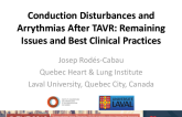 Conduction Disturbances and Arrhythmias After TAVR: Remaining Issues and Best Clinical Practices