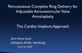 Cardiac Implant Complete Ring