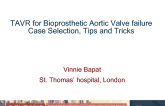 TAVR for Bioprosthetic Aortic Valve Failure: Case Selection, Procedural Tips and Tricks, and Outcomes