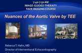 Nuances of the Aortic Valve by TEE