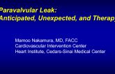 Paravalvular Leak: Anticipated, Unexpected, and Therapy: Case Presentation (Two Examples)