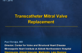 Landscape, Opportunities, and Challenges for Transcatheter MV Replacement