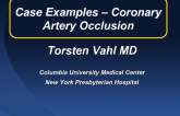 Aspects of Managing the Coronary Artery Preservation: Case Presentation (Two Examples)