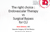 The Right Choice: Endovascular Therapy vs Surgical Bypass for CLI