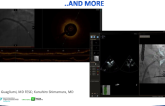 Angiographic Coregistration of IVUS, OCT, FFR, iFR, and More