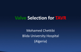 Valve Selection for TAVR: Similarities and Differences; How to Choose