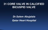TAVR Case Study With a Self-Expanding Valve