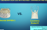 Choice of Sapien vs CoreValve TAVR