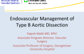 Endovascular Management of Type B Aortic Dissection