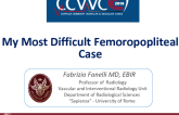 My Most Difficult Femoropopliteal Case