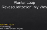 Plantar Loop Revascularization: My Way