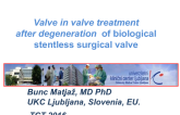 Case Reviews: TAVR Valve-in-Valve