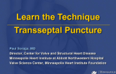 Step-by-step Basic Transseptal Puncture