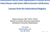 Transcatheter Valve Replacement for Native Mitral Stenosis: Lessons from the International Registry