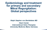 Epidemiology and Treatment of Primary and Secondary Mitral Regurgitation: Global Perspectives