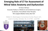 Emerging Role of CT for Assessment of Mitral Valve Anatomy and Dysfunction
