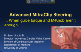 Case #1: Advanced MitraClip Steering: When Guide Torque and M-Knob Aren't Enough