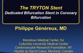 Bifurcation/Left Main Stents I: Tryton