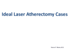 Flash Perspectives on Calcium Management: The Case for Laser Atherectomy!