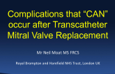 Complications That Can Occur After Transcatheter Mitral Valve Replacement
