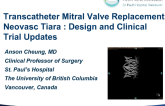 Neovasc Tiara: Design and Clinical Trial Updates
