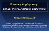 Coronary Angiography: Set-up, Views, Artifacts, and Pitfalls