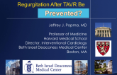 Complications 1. Para-Valvular Regurgitation: Should Mild Para-Valvular Regurgitation After TAVR Be Treated?