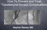 Complications 2. How to Prevent and Treat Transfemoral Access Site Complications