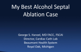 My Best Alcohol Septal Ablation Case