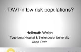 Debate: Should All Low-Risk Patients With Severe Aortic Stenosis Who are Suitable Be Allowed to Choose TAVR Rather than Surgical AVR, Without Further Trial Evidence? Con Position