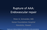 Management of Ruptured Abdominal Aortic Aneurysms - Open vs Endovascular Repair