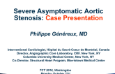 Severe Asymptomatic AS