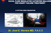 Caval Flow Regulator Catheter Balloon for Heart Failure Treatment