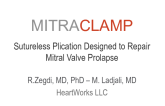 Percutaneous Plication of Mitral Valve Prolapse (MitraClamp)