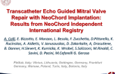 TCT 42: Transcatheter Echo Guided Mitral Valve Repair With Neochord Implantation for Posterior Leaflet Disease: Results From Neochord Independent International Registry