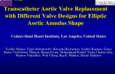 TCT 83: Transcatheter Aortic Valve Replacement With Different Valve Designs for Elliptic Aortic Annulus Shape