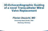 3D-Echocardiographic Guiding of a Novel Transcatheter Mitral Valve Replacement