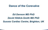 TCT 1515: The Dance of the Corevalve