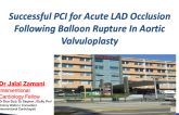 TCT 1540: Successful PCI for Acute LAD Occlusion Due to Balloon Rupture Following Aortic Valvuloplasty
