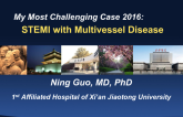 My Most Challenging Case 2016: STEMI with Multivessel Disease