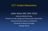 Hibernating Aneurysm and Ectatic SFA With Large Thrombus Burden Identified Using OCT Guided Atherectomy: Changing Algorithms of Care Using Real-Time Imaging During Therapy