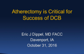 Great Debate 2: Atherectomy Is Critical for Success of DCB!