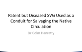 Case #4: Patent but Diseased SVG Used as a Conduit for Salvaging the Native Circulation
