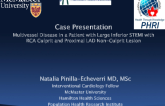 Case Presentation: Multivessel Disease in a Patient With Large Inferior STEMI With RCA Culprit and Proximal LAD Non-Culprit Lesion