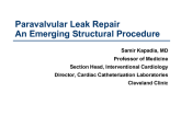 Paravalvular Leak Repair: An Emerging Structural Procedure