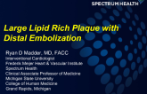 Case #5: Large Lipid Rich Plaque With Distal Embolization