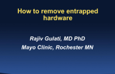 Case Presentation(s): How to Remove Entrapped Hardware