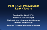Case #2. Post-TAVR Paravalvulular Leak